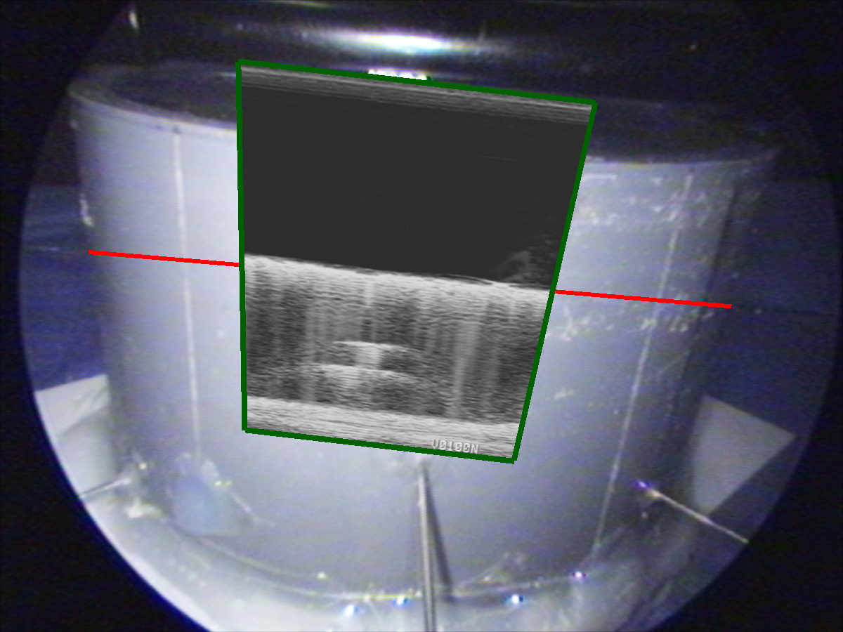 Magneto-Optic Tracking of a Flexible Laparoscopic Ultrasound Transducer