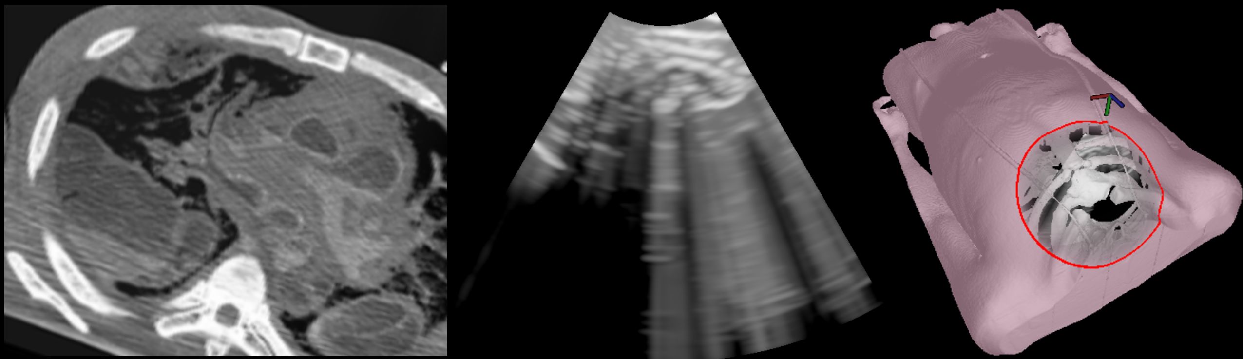 Simulated Ultrasound