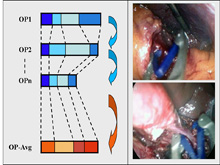Surgical Workflow Analysis in Laparoscopy for Monitoring and Documentation 