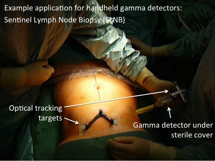 Intra-Operative usage of a gamma detector