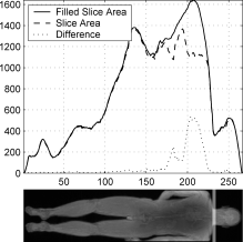 Patient Position Detection for SAR Optimization in Magnetic Resonance Imaging