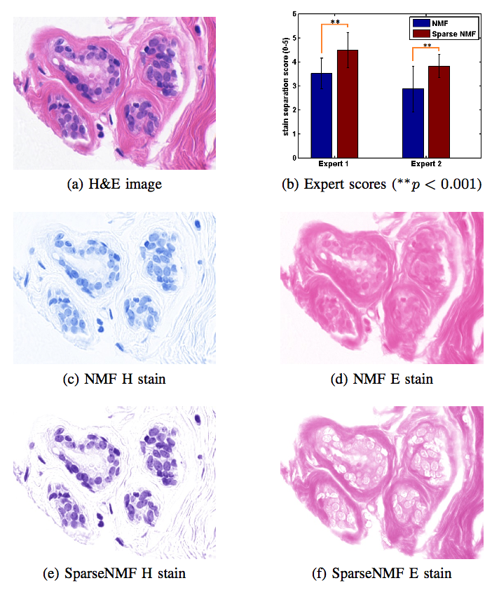 Stain Separation and Structure-Preserving Color Normalization for Histological Images