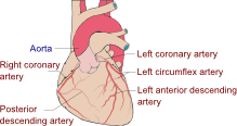 Decision Support System for Treating Patients with Coronary Artery Disease