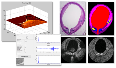 Intravascular Ultrasound Simulation from Histology