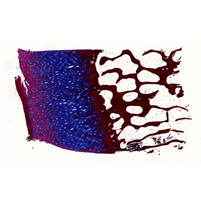 stained histology slice of cartilage