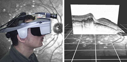 Advanced imaging in Head Mounted Displays (HMD) for Patients with Age-Related Macular Degeneration