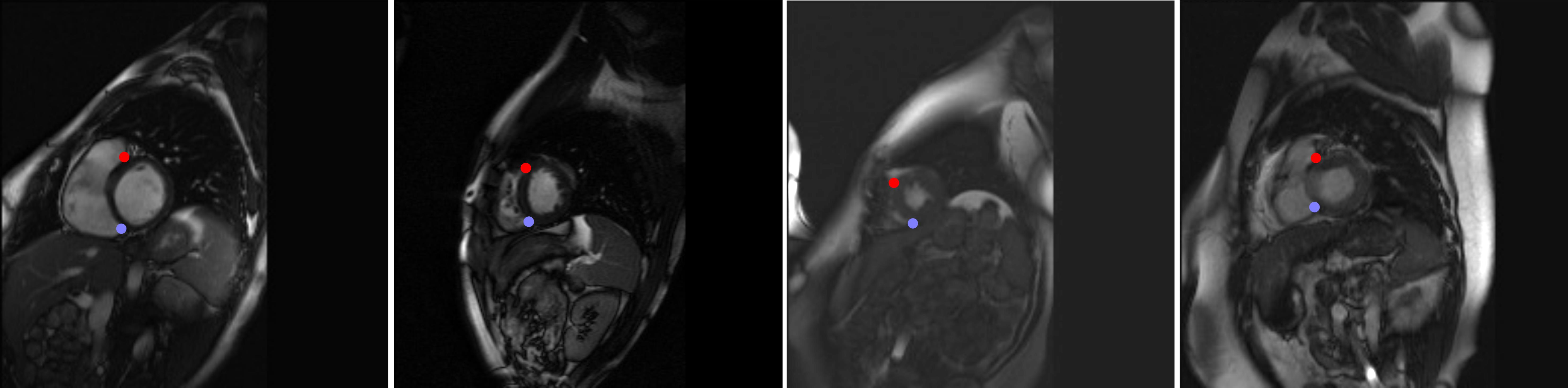 Example Cardiac Landmarks in MRIs