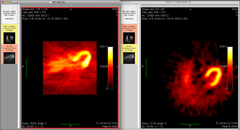 Osirix screenshot 1