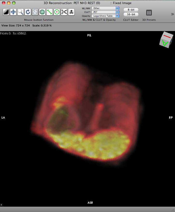 Osirix screenshot 3