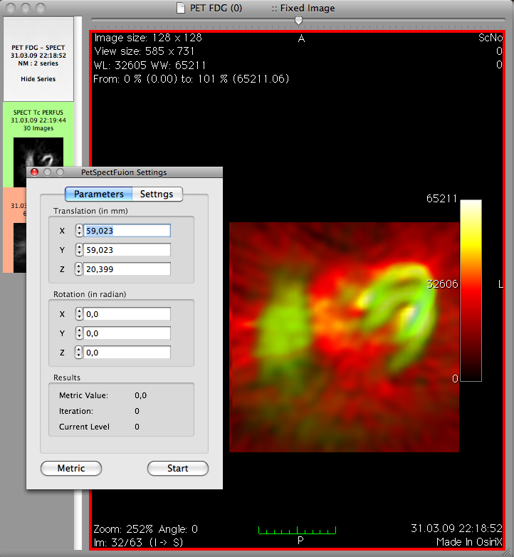 Osirix screenshot 2